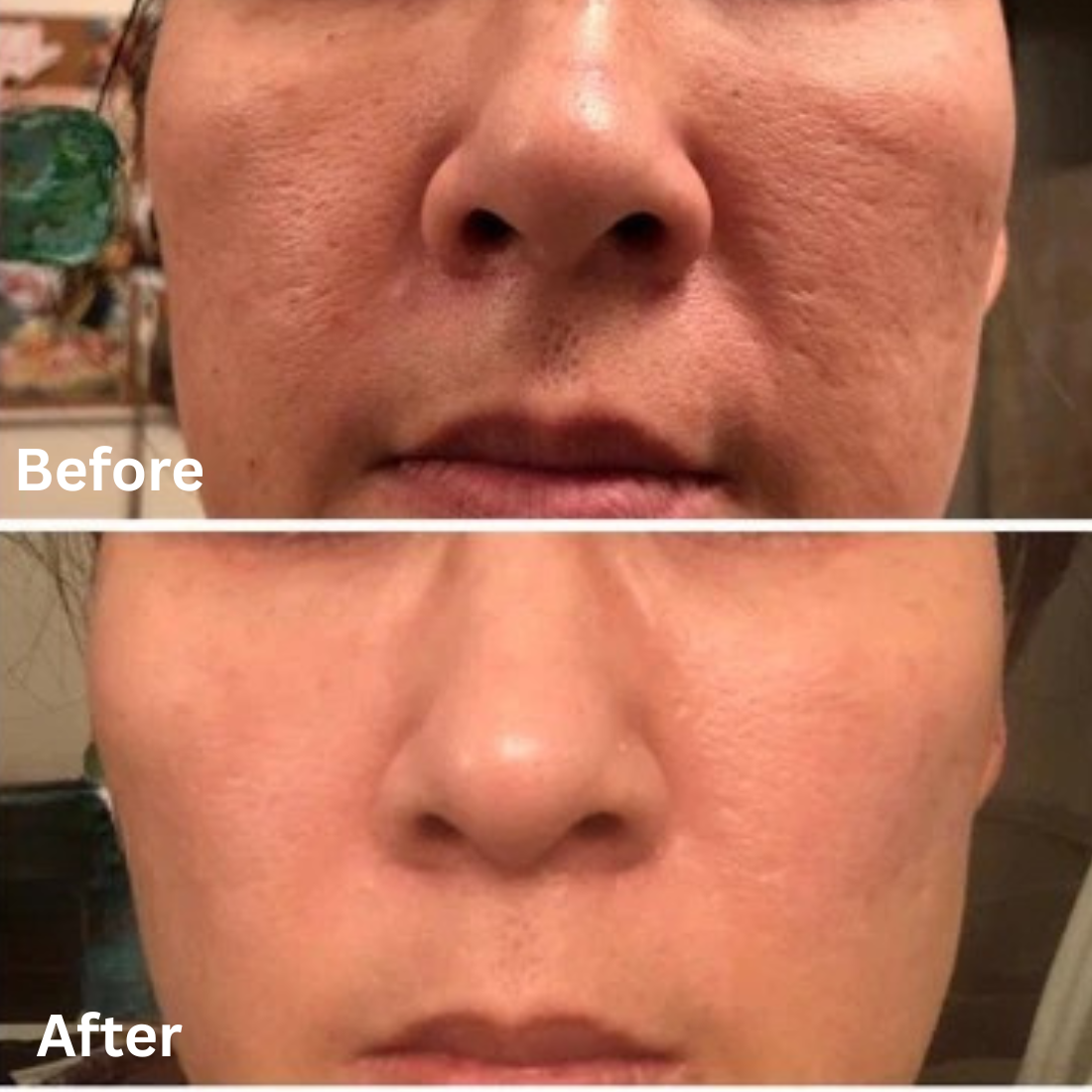Azelaic Soothe Serum