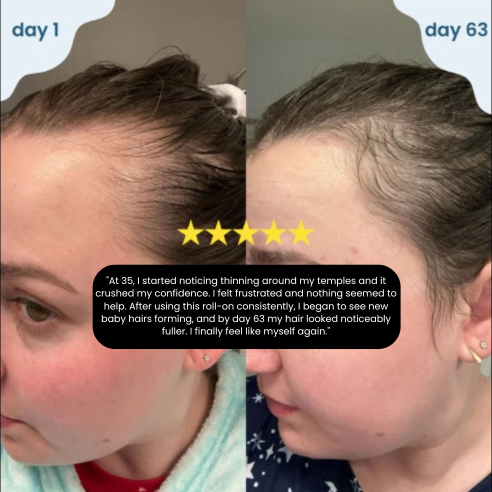 Hair Growth Roll on Serum