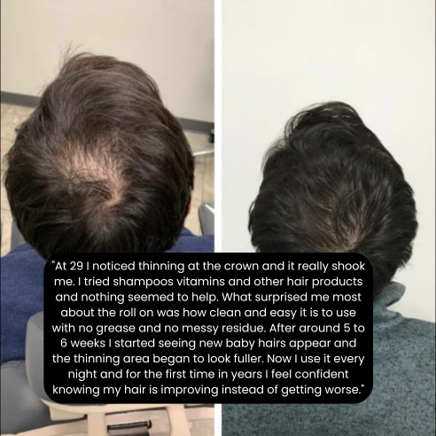 Hair Growth Roll on Serum