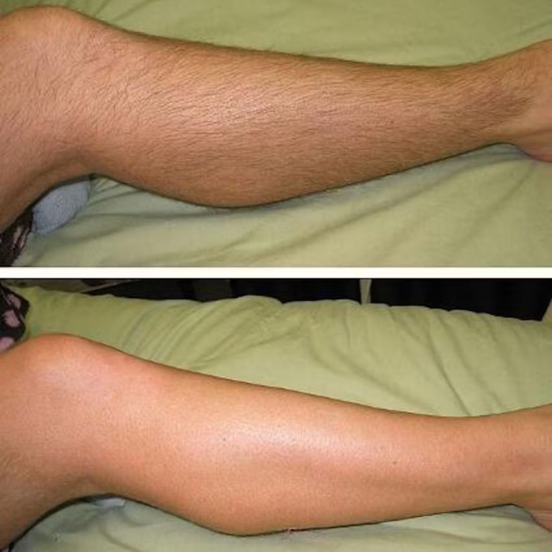 Hyaluronic Cloud Hair Removal Mist