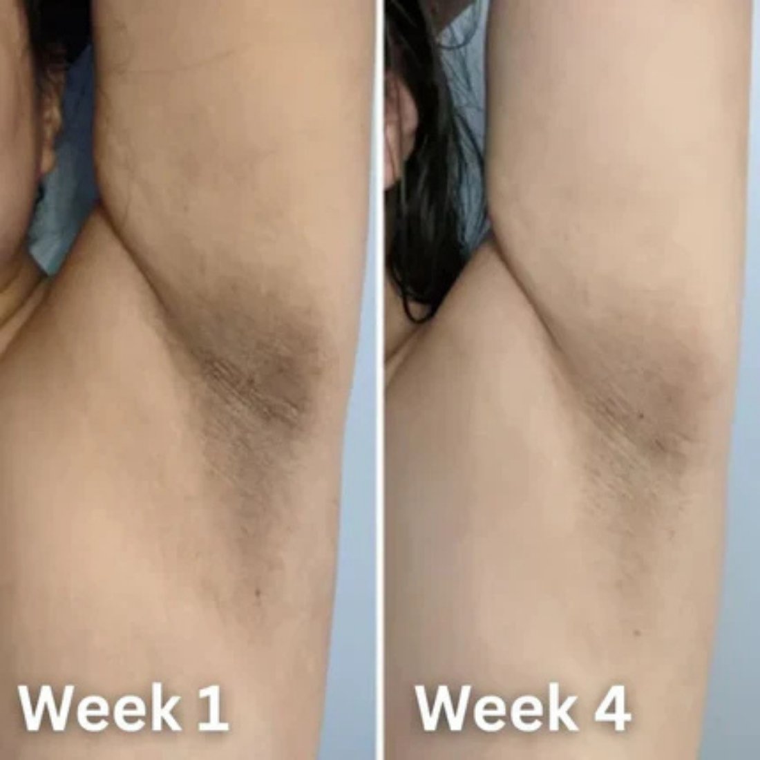 Kojic Glow Brightening Deodorant