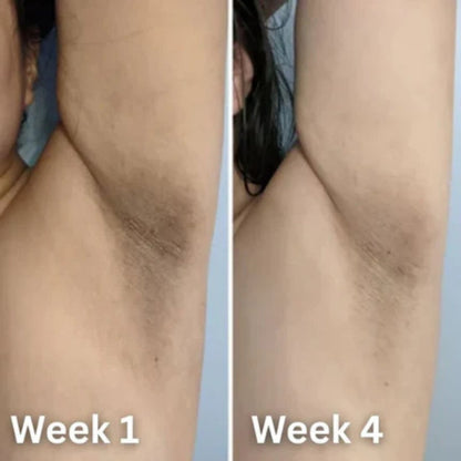 Kojic Glow Brightening Deodorant