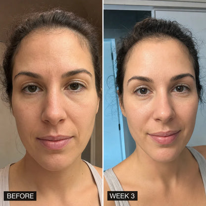 PDRN Plump Capsule Cream